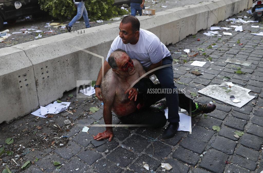 Hussein Malla Lebanese man helps an injured man who was wounded by an explosion that hit the seaport, in Beirut Lebanon, Tuesday, Aug. 4, 2020. (AP Photo/Hussein Malla)