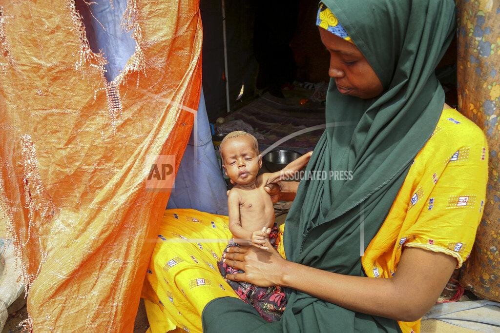Farah Abdi Warsameh Amina Shuto, 21, who fled the drought-stricken Lower Shabelle area, holds her two-month old malnourished child at a makeshift camp for the displaced on the outskirts of Mogadishu, Somalia Thursday, June 30, 2022. The war in Ukraine has abruptly drawn millions of dollars away from longer-running humanitarian crises and Somalia is perhaps the most vulnerable as thousands die of hunger amid the driest drought in decades. (AP Photo/Farah Abdi Warsameh)