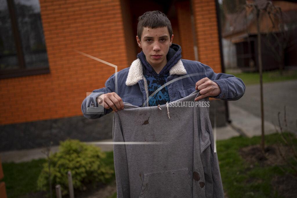 Emilio Morenatti Yura Nechyporenko, 15, holds the hoodie he was wearing the day a Russian soldier tried to execute him in Bucha, on the outskirts of Kyiv, Ukraine, on Tuesday, April 19, 2022. His father was killed, and now his family seeks justice. The hoodie, bloodied at the elbow where a bullet had pierced him, is now the centerpiece of the family's search for justice. Yura's mother, Alla, insisted that it not be thrown away. (AP Photo/Emilio Morenatti)