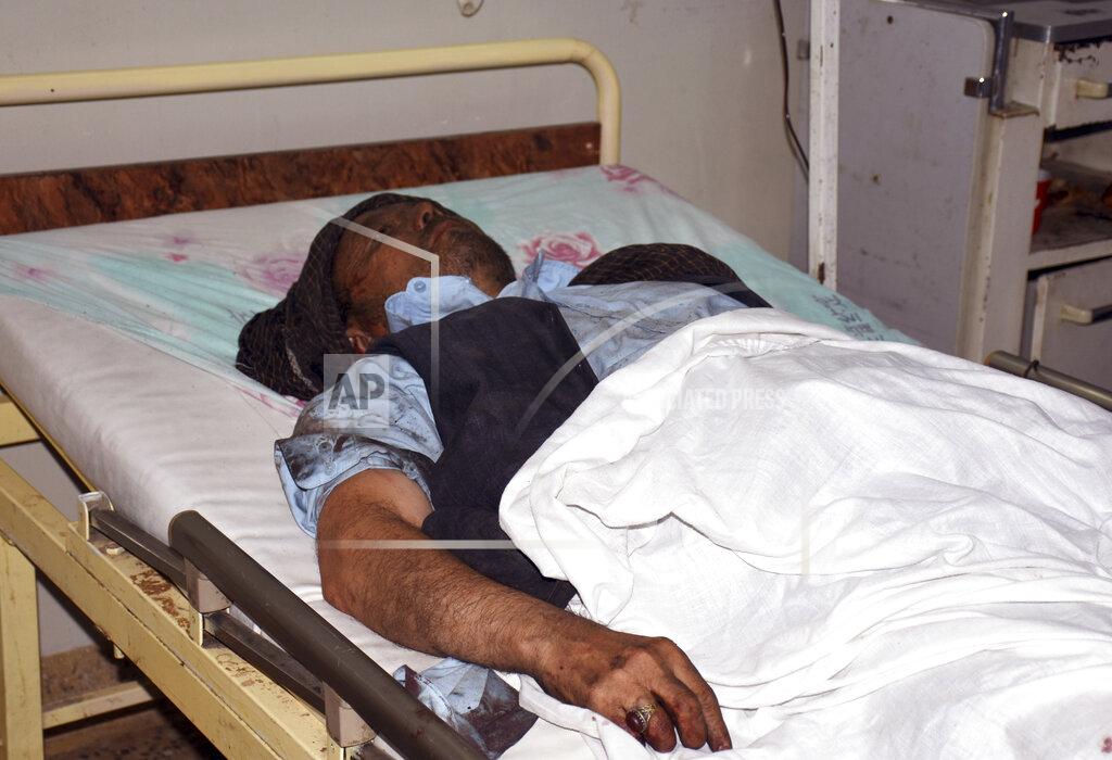 Masih Paeiz A wounded man receives treatment in a hospital, after a bombing in Mazar-e-Sharif, northern Afghanistan, Wednesday, May 25, 2022. A series of explosions shook Afghanistan on Wednesday, the Taliban said, including a blast inside a mosque in the capital of Kabul that killed at least five worshippers and three bombings of minivans in the country's north that killed nine passengers. (AP Photo/Masih Paeiz)