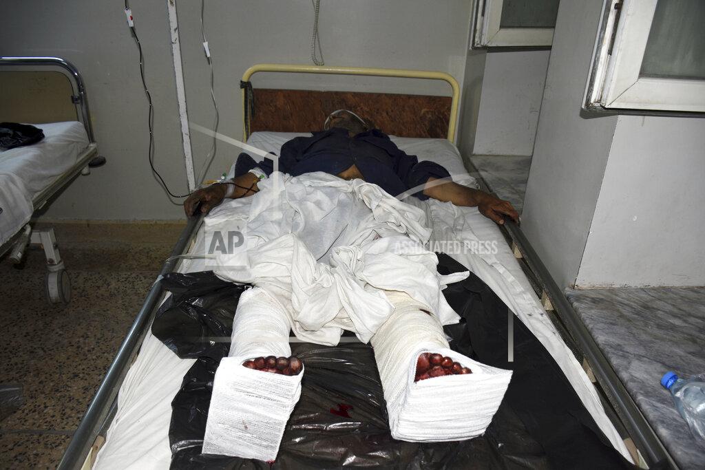 Masih Paeiz A wounded man receives treatment in a hospital, after a bombing in Mazar-e-Sharif, northern Afghanistan, Wednesday, May 25, 2022. A series of explosions shook Afghanistan on Wednesday, the Taliban said, including a blast inside a mosque in the capital of Kabul that killed at least five worshippers and three bombings of minivans in the country's north that killed nine passengers. (AP Photo/Masih Paeiz)
