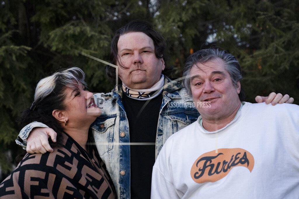 Mark Lennihan Joe DiMeo stands with his parents Rose and John in the backyard of their home in Clark, N.J., Thursday, Jan. 28, 2021, six months after an extremely rare double hand and face transplant. “In the future, I have a lot more plans for myself,” he said. “You got a new chance at life. You really can’t give up.” (AP Photo/Mark Lennihan)