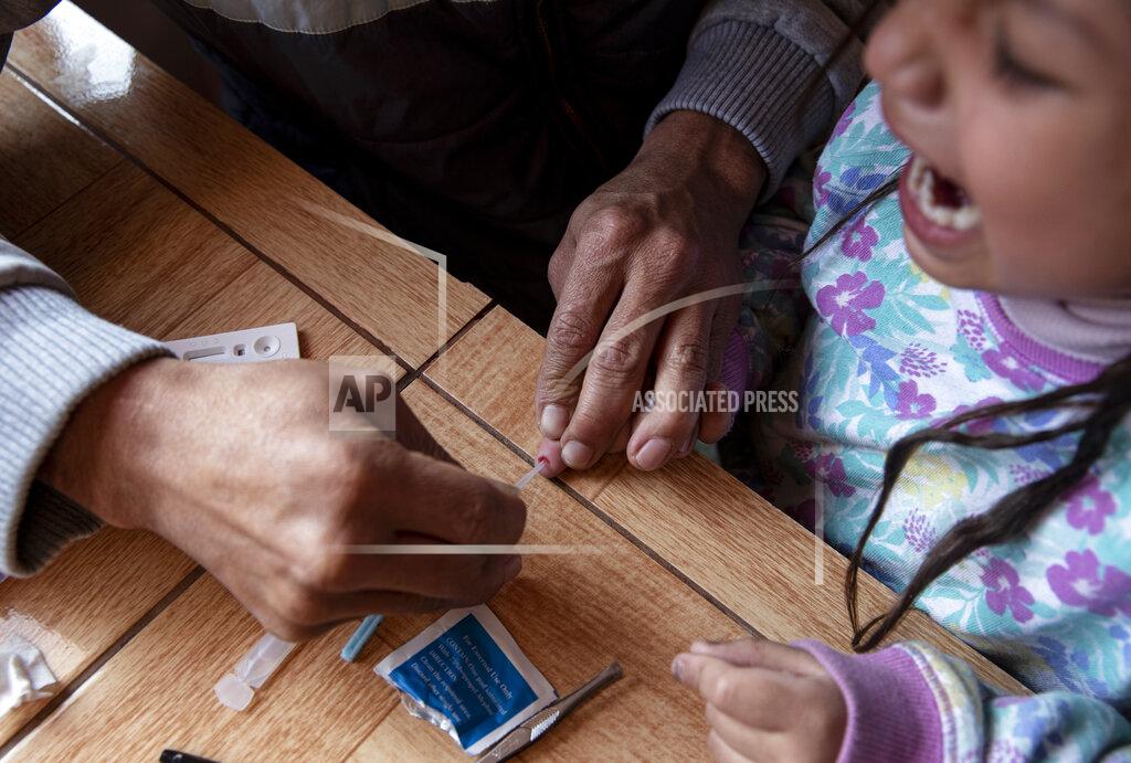 Esteban Felix Jose Collantes gives his five-year-old daughter Kehity a COVID-19 anti-body test, which resulted positive although she did not have symptoms, at home where they live with his sister in Santiago, Chile, Wednesday, Aug. 19, 2020, two months after his wife, her mother, died of the new coronavirus. Jose got the virus at end of April, and he quarantined himself in one of the hotels the government set up for COVID patients, but he only exhibited mild symptoms. (AP Photo/Esteban Felix)