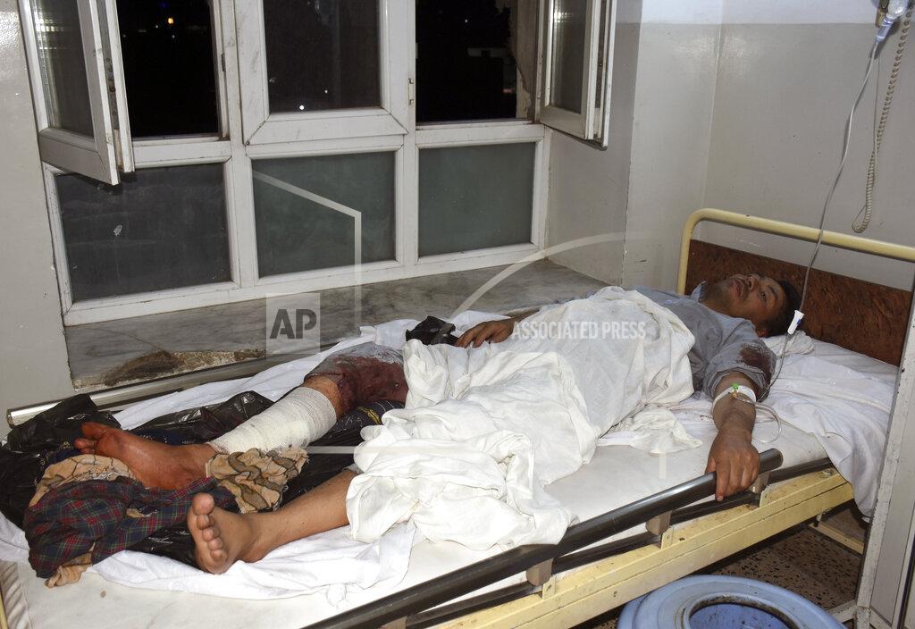 Masih Paeiz A wounded man receives treatment in a hospital, after a bombing in Mazar-e-Sharif, northern Afghanistan, Wednesday, May 25, 2022. A series of explosions shook Afghanistan on Wednesday, the Taliban said, including a blast inside a mosque in the capital of Kabul that killed at least five worshippers and three bombings of minivans in the country's north that killed nine passengers. (AP Photo/Masih Paeiz)