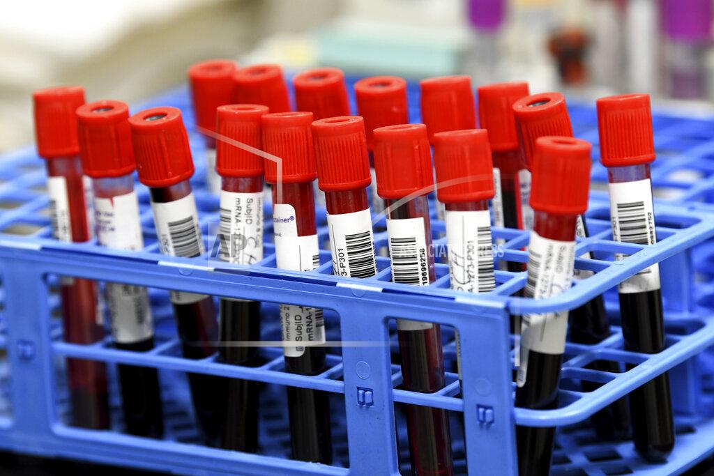 Taimy Alvarez Blood samples from volunteers participating in the National Institutes of Health-funded Moderna COVID-19 vaccine third phase clinical trail wait to be processed in a lab at the University of Miami Miller School of Medicine in Miami, Fla., Wednesday, Sept. 2, 2020 in Miami. (AP Photo/Taimy Alvarez)