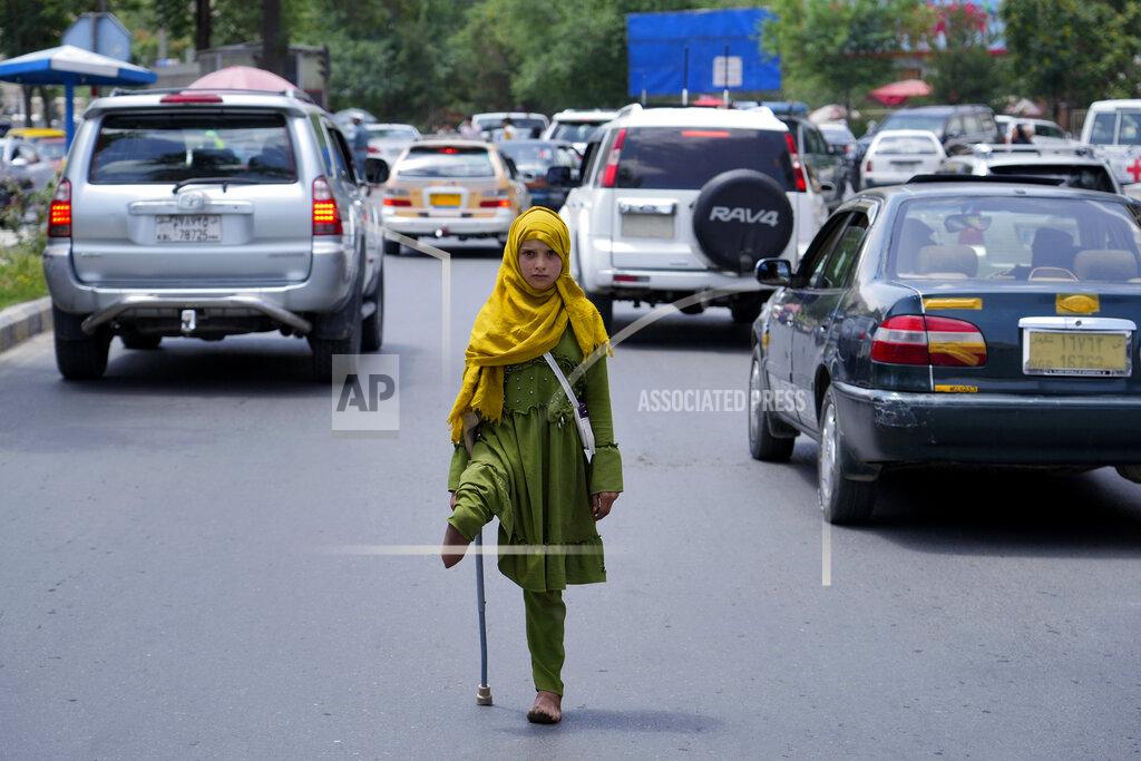 Ebrahim Noroozi A disabled girl begs in Kabul, Afghanistan, Sunday, May 22, 2022. Some 1.1 million Afghan children under the age of five will face malnutrition by the end of the year. , as hospitals wards are already packed with sick children . (AP Photo/Ebrahim Noroozi)