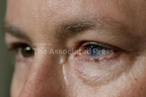Stem cells from one eye show promise in healing injurie... - Vimarsana News