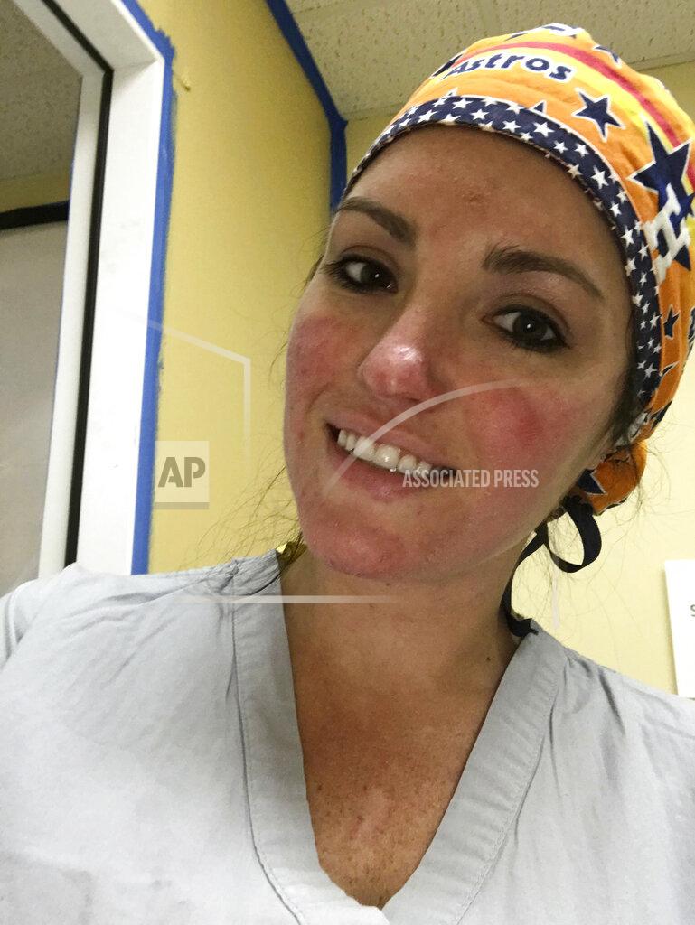 This undated photo provided by hospital ICU nurse Stormy Tatom shows her in Beaumont, Texas, after taking care of COVID-19 patients in an N95 mask for 12 hours. Tatom said she decided against getting vaccinated for now “because of the unknown long-term side effects.” (Stormy Tatom via AP)