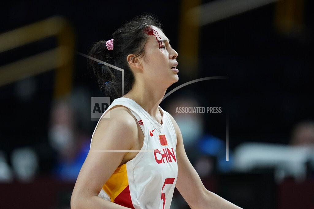 Charlie Neibergall China's Siyu Wang (5) bleeds from her head after colliding with Australia's Katie Ebzery during a women's basketball preliminary round game at the 2020 Summer Olympics in Saitama, Japan, Friday, July 30, 2021. (AP Photo/Charlie Neibergall)