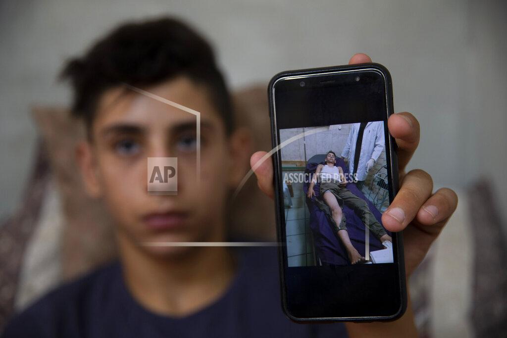 Majdi Mohammed Palestinian youth, Tareq Zubeidi, 15, shows an image of his wounds at his house, in the West Bank village of Silat ad-Dhahr, Tuesday, Aug. 31, 2021. Zubeidi says he was abducted and beaten by a group of Israeli settlers after they found him and his friends eating snacks near an evacuated hilltop settlement in the occupied West Bank. More than two weeks after the Aug. 17 incident, he says he can barely walk and is afraid to leave his home. (AP Photo/Majdi Mohammed)