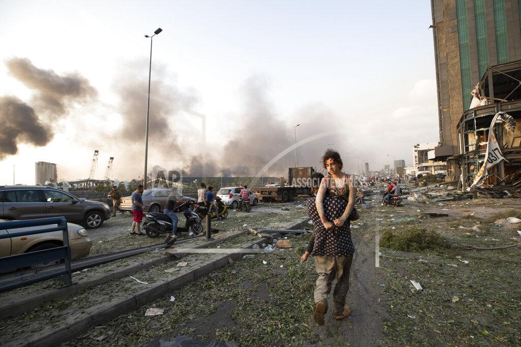 Hassan Ammar People evacuate wounded after of a massive explosion in Beirut, Lebanon, Tuesday, Aug. 4, 2020. Massive explosions rocked downtown Beirut on Tuesday, flattening much of the port, damaging buildings and blowing out windows and doors as a giant mushroom cloud rose above the capital. Witnesses saw many people injured by flying glass and debris. (AP Photo/Hassan Ammar)