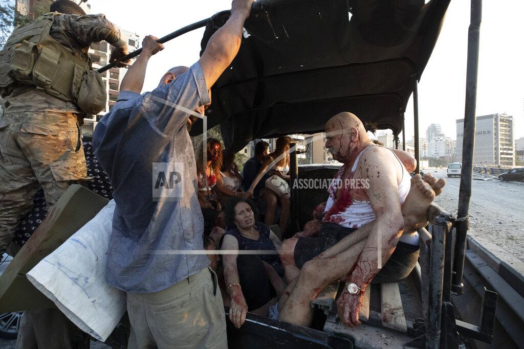 Hassan Ammar Injrued are evacuated after a massive explosion in Beirut, Lebanon, Tuesday, Aug. 4, 2020. Massive explosions rocked downtown Beirut on Tuesday, flattening much of the port, damaging buildings and blowing out windows and doors as a giant mushroom cloud rose above the capital. Witnesses saw many people injured by flying glass and debris. (AP Photo/Hassan Ammar)