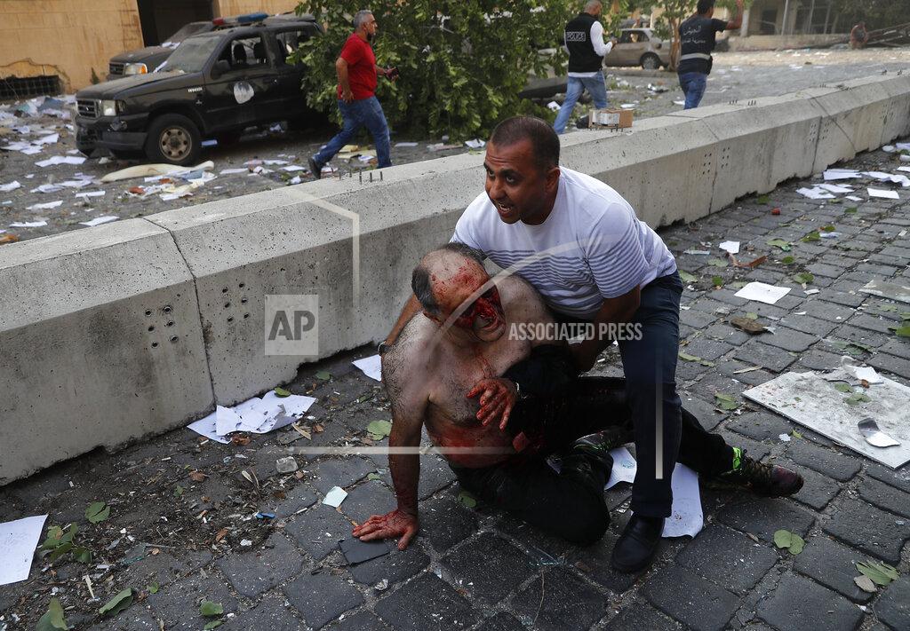 Hussein Malla FILE - In this August 4, 2020 file photo, a Lebanese man helps an injured man who was wounded by an explosion that hit the seaport of Beirut, Lebanon, Tuesday, Aug. 4, 2020. The mental health impact of the Beirut explosion that killed more than 200 and wounded more than 6,000 continues to lay its heavy weight on those who managed to survive the day. (AP Photo/Hussein Malla, File)