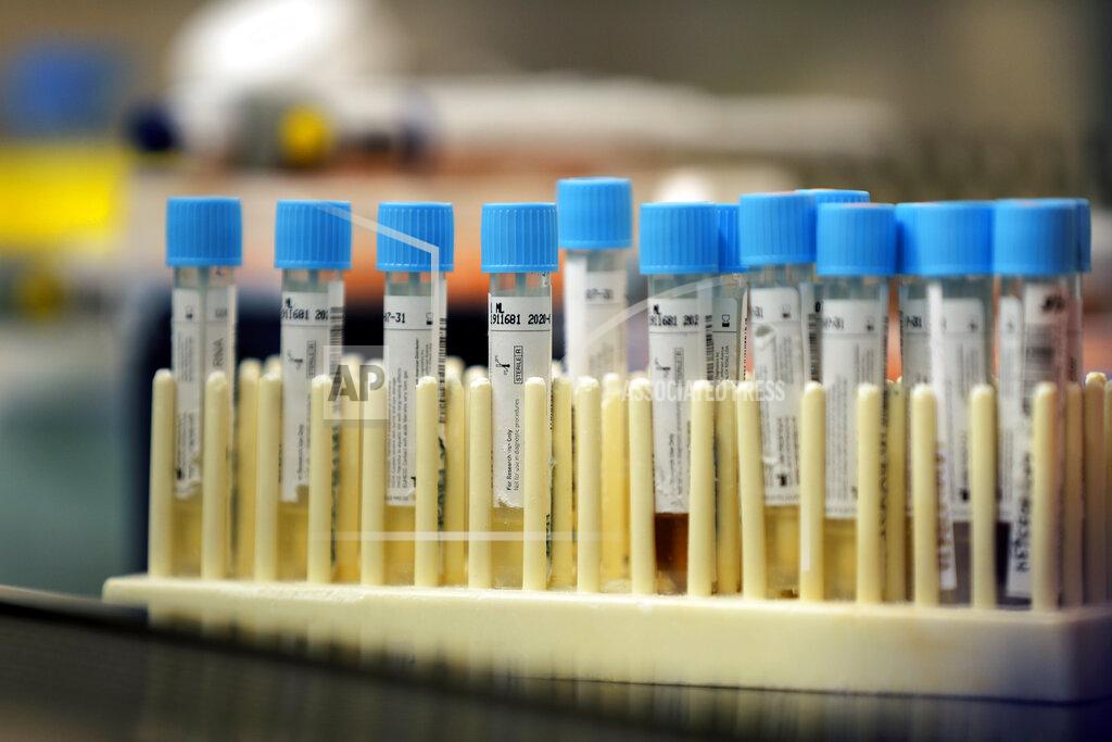 Gerald Herbert FILE - In this April 2, 2020 file photo, vials with samples taken for the new coronavirus are seen before they are prepared for RNA testing at the molecular pathology lab at Tulane University School of Medicine in New Orleans. Where political divides marred early recovery efforts after Hurricane Katrina in 2005, Louisiana is showing rare political unity in the fight against the new coronavirus. (AP Photo/Gerald Herbert, File)