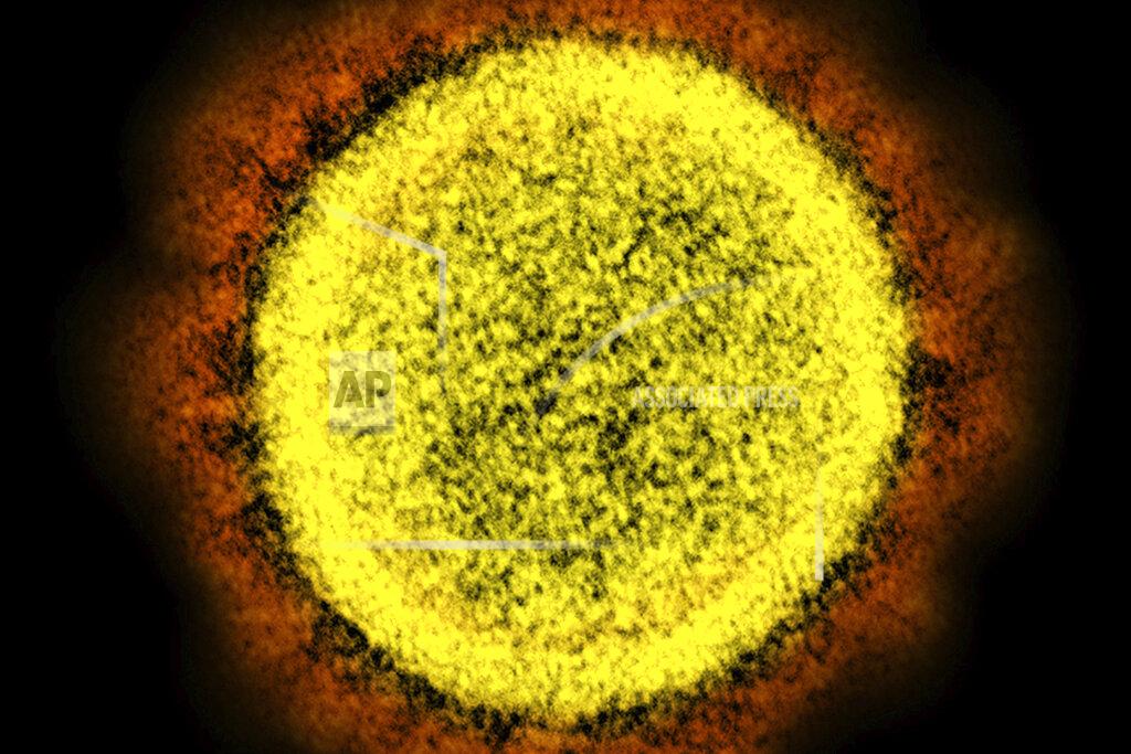 FILE - This 2020 electron microscope image made available by the National Institute of Allergy and Infectious Diseases shows a Novel Coronavirus SARS-CoV-2 particle isolated from a patient, in a laboratory in Fort Detrick, Md. Coronaviruses, including the newest one, are named for the spikes that cover their outer surface like a crown, or corona in Latin. Using those club-shaped spikes, the virus latches on to the outer wall of a human cell, invades it and replicates, creating viruses to hijack more cells. (NIAID/NIH via AP)