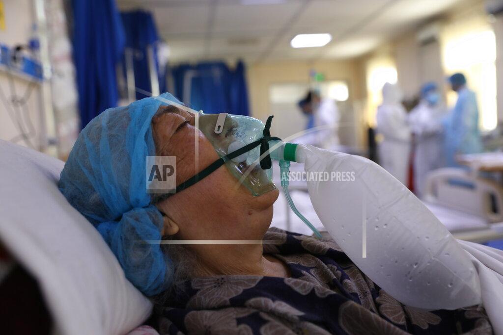Rahmat Gul A patient is connected to oxygen tank in the intensive care unit ward for COVID-19 patients at the Afghan-Japan Communicable Disease Hospital in Kabul, Afghanistan, Sunday, May 30, 2021. Afghanistan is battling a brutal third wave of COVID infections, while health officials plead for vaccines, expressing deep frustration at the inequities of the global vaccine distribution. Positive COVID cases jump from eight percent to 60 per cent in some parts of the country. (AP Photo/Rahmat Gul)