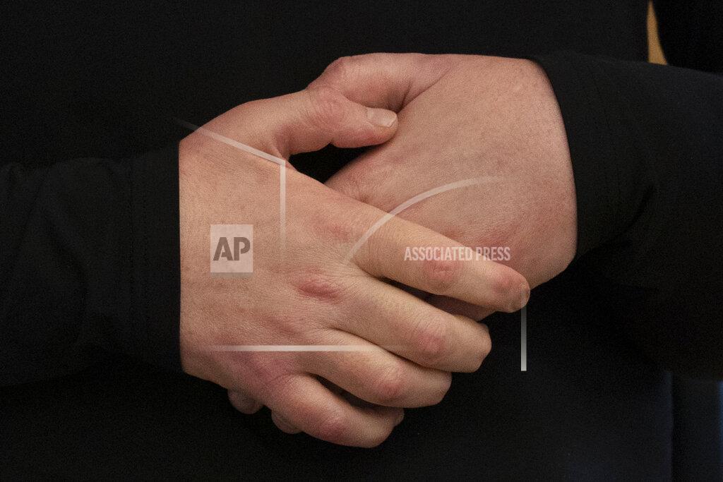 Mark Lennihan Joe DiMeo clasps his new hands, Jan. 25, 2021 in New York. In the months since his transplant surgery, DiMeo has not shown any signs of rejecting his new face or hands. (AP Photo/Mark Lennihan)