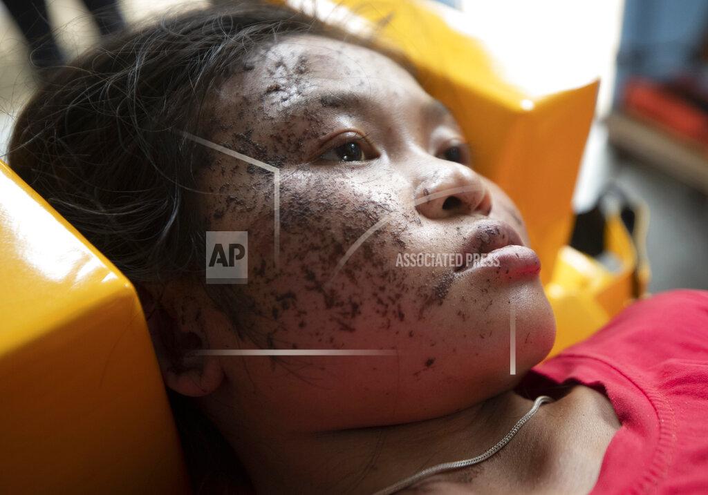 Sakchai Lalit An injured ethnic Karen villager from Myanmar rests as she is treated after crossing the Salawin river via boat at Ban Mae Sam Laep Health Center, Mae Hong Son province, Thailand on Tuesday March 30, 2021. The weekend strikes by the Myanmar military, which sent ethnic people to seek safety in Thailand, represented another escalation in the violent crackdown by Myanmar’s junta on protests of its Feb. 1 takeover. (AP Photo/Sakchai Lalit)