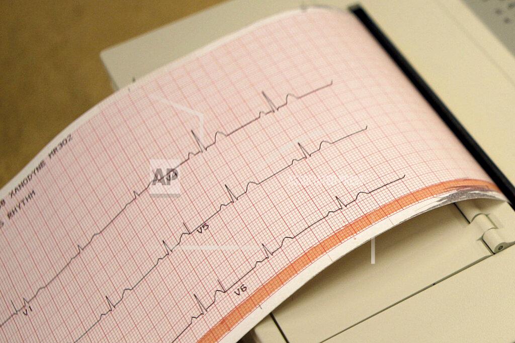 FILE - This May 26, 2009 file photo shows a printout from an electrocardiogram machine in Missouri. Doctors are reporting that novel drugs may offer fresh ways to reduce heart risks beyond the usual medicines to lower cholesterol and blood pressure. One new study found that heart attack survivors benefited from a medicine long used to treat gout. Gene-targeting medicines also showed promise in studies discussed Monday, Nov. 18, 2019, at an American Heart Association conference in Philadelphia. (AP Photo/Jeff Roberson)
