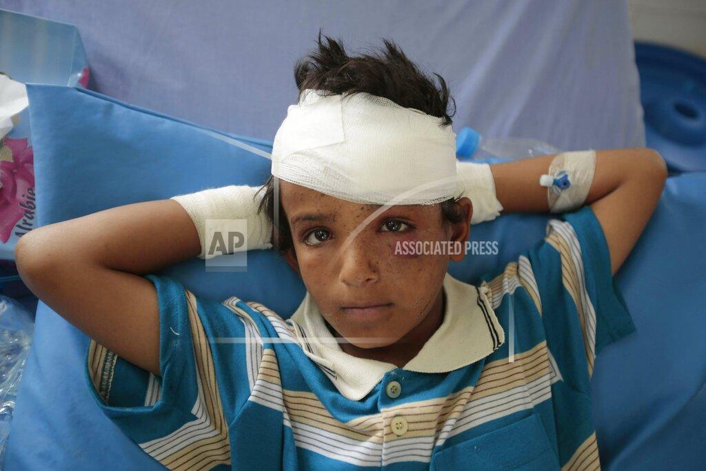 Hani Mohammed FILE - In this Aug. 12, 2018 file, photo, a child who was injured in a deadly Saudi-led coalition airstrike rests in a hospital in Saada, Yemen. The United Nations said Tuesday, Oct. 19, 2021 that more than 10,000 children in Yemen have now been killed or injured in violence linked to years of war in the impoverished country. The children’s agency UNICEF said the verified tally is surely an undercount of the real toll. (AP Photo/Hani Mohammed, File)