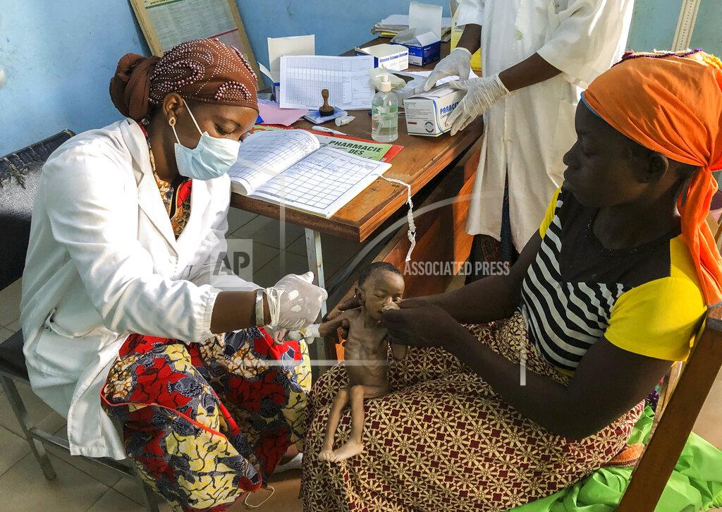 Sam Mednick One-month old Haboue Solange Boue sits on the lap of her mother Danssanin Lanizou, 30, right, as a nurse inserts an intravenous drip into her arm to treat her for severe malnutrition at the feeding center of the main hospital in the town of Hounde, Tuy Province, in southwestern Burkina Faso on Thursday, June 11, 2020. All around the world, the coronavirus and its restrictions are pushing already hungry communities over the edge, cutting off meager farms from markets and isolating villages from food and medical aid. (AP Photo/Sam Mednick)