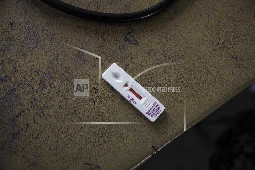 Nariman El-Mofty A malaria test indicates a positive result for Tigrayan refugee Hareg, 23, from Mekelle, Ethiopia, administered by surgeon and doctor-turned-refugee, Dr. Tewodros Tefera, at the Sudanese Red Crescent clinic in Hamdayet, eastern Sudan, near the border with Ethiopia, on March 17, 2021. (AP Photo/Nariman El-Mofty)