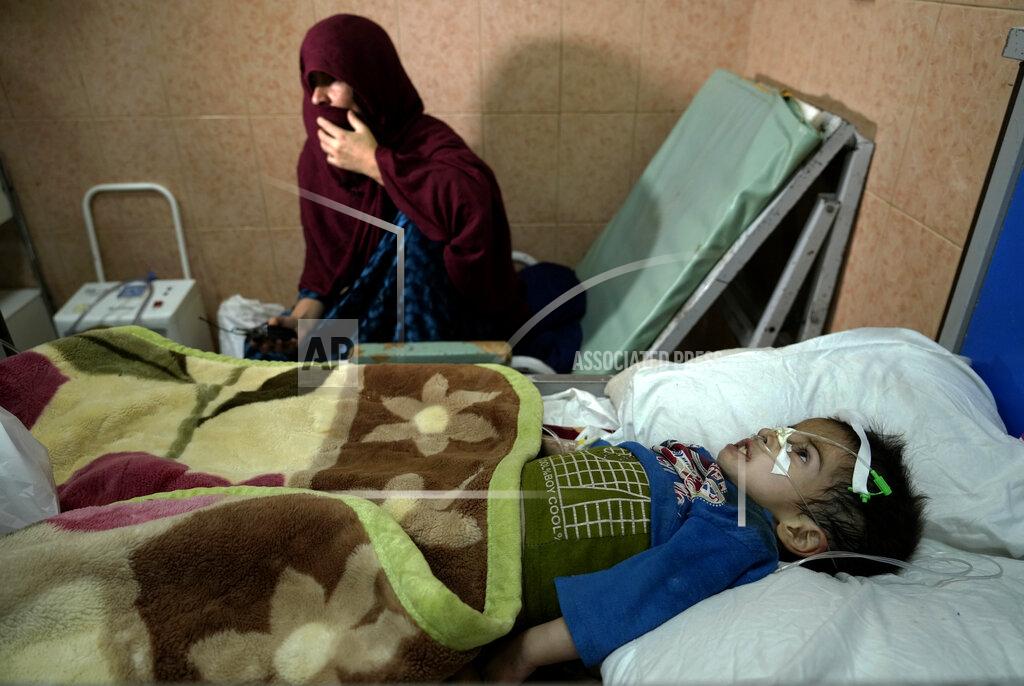 Ebrahim Noroozi An acute malnourished boy lies on a bed at the malnutrition ward of the Indira Gandhi hospital in Kabul, Afghanistan, Wednesday, May 18, 2022. Some 1.1 million Afghan children under the age of five will face malnutrition by the end of the year. , as hospitals wards are already packed with sick children . (AP Photo/Ebrahim Noroozi)