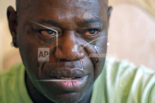 FIILE - Aaron Larry Bowman cries during an interview at his attorney's office in Monroe, La., Thursday, Aug. 5, 2021, as he discusses his injuries resulting from a Louisiana State trooper pummeling him with a flashlight during a traffic stop. A former Louisiana State Police trooper pleaded not guilty Wednesday, Oct. 13, 2021, to a federal charge in the 2019 video recorded beating of Bowman whose injuries included a broken jaw and broken ribs. Jacob Brown is charged with “deprivation of rights under color of law” in the beating of Bowman following a north Louisiana traffic stop. (AP Photo/Rogelio V. Solis, File)