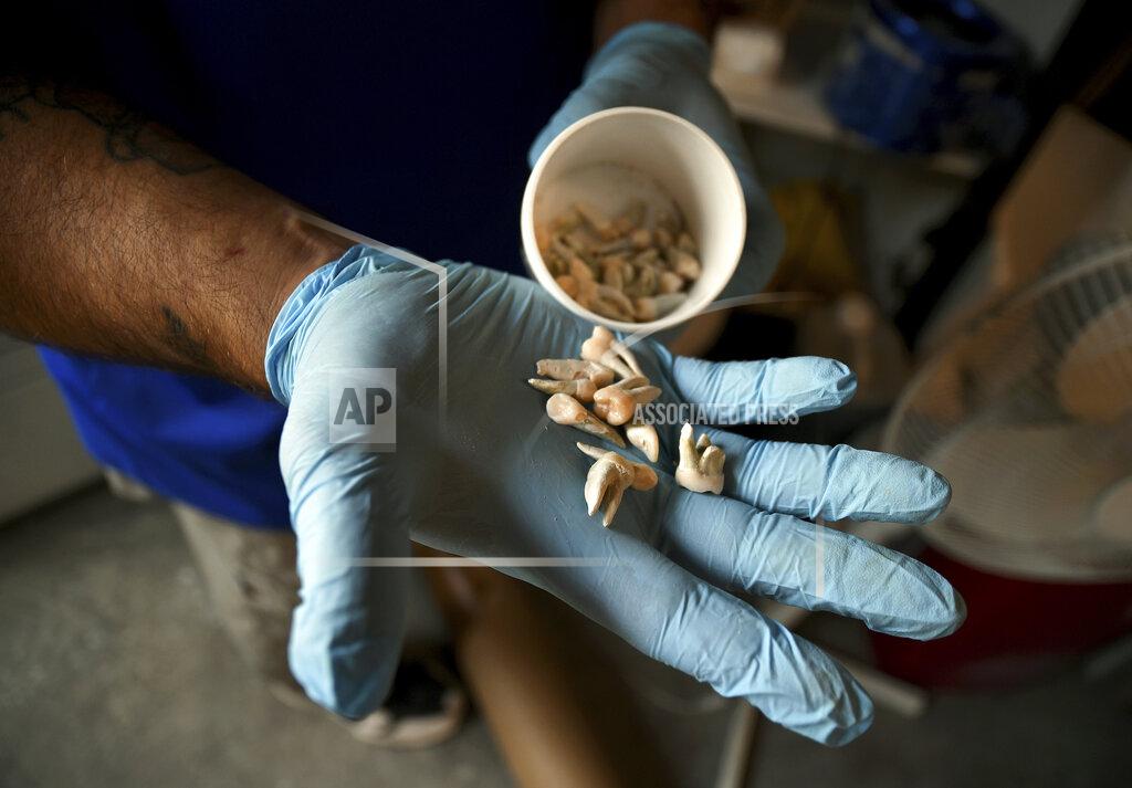 Thomas Peipert In this Wednesday, Aug. 11, 2021, photo, employee Chris Olachia shows a handful of teeth at The Natural Funeral's human body composting facility in Arvada, Colo. On Sept. 7, Colorado became the second state after Washington to allow human body composting, and Oregon will allow the practice beginning next July. Vessels will be packed with wood chips and straw and will compost a body in six months. Teeth are removed during cremation and composting to prevent mercury contained in dental fillings from contaminating the environment. (AP Photo/Thomas Peipert)