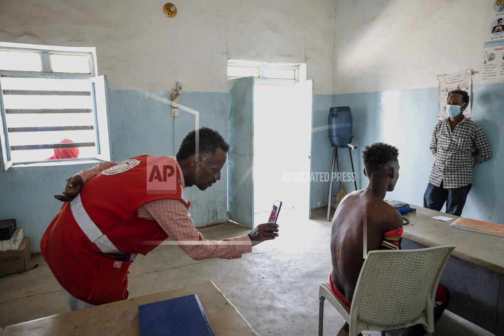 Nariman El-Mofty Surgeon and doctor-turned-refugee, Dr. Tewodros Tefera, uses his mobile phone camera to document the welts on the back from a beating by Eritrean soldiers of Adhanom Gebrehanis, a 20-year-old Tigrayan refugee from Korarit village, at the Sudanese Red Crescent clinic shortly after his arrival in Hamdayet, eastern Sudan, near the border with Ethiopia, on March 17, 2021. “It is definitely genocide,” he says. “If someone is being attacked for their identity, if they’re threatened to be vanished because of their identity, there is no other explanation for this.” (AP Photo/Nariman El-Mofty)