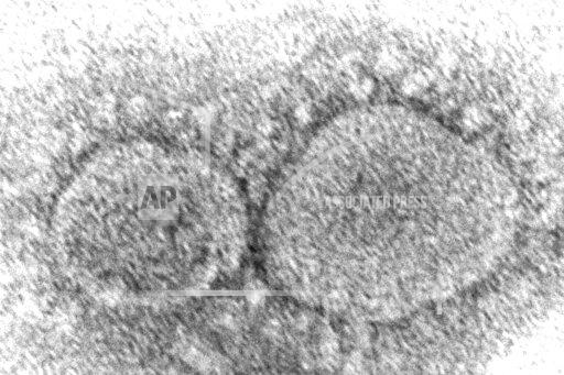 FILE - This 2020 electron microscope image made available by the Centers for Disease Control and Prevention shows SARS-CoV-2 virus particles which cause COVID-19. The World Health Organization has appointed an independent scientific panel to advise on whether vaccine shots need reformulating because of omicron or any other mutant. (Hannah A. Bullock, Azaibi Tamin/CDC via AP, File)