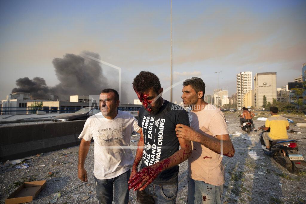 Hassan Ammar People help a man who was wounded in a massive explosion in Beirut, Lebanon, Tuesday, Aug. 4, 2020. Massive explosions rocked downtown Beirut on Tuesday, flattening much of the port, damaging buildings and blowing out windows and doors as a giant mushroom cloud rose above the capital. Witnesses saw many people injured by flying glass and debris. (AP Photo/Hassan Ammar)