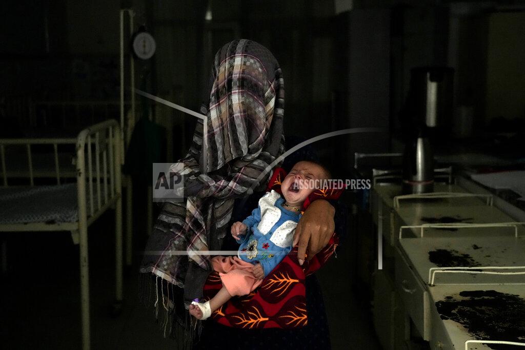 Ebrahim Noroozi Nazia 30, who has lost four children due to severe malnutrition, holds her malnourished baby in a hospital in Parwan province north of Kabul, Afghanistan, Thursday, May 19, 2022. Some 1.1 million Afghan children under the age of five will face malnutrition by the end of the year. , as hospitals wards are already packed with sick children . (AP Photo/Ebrahim Noroozi)
