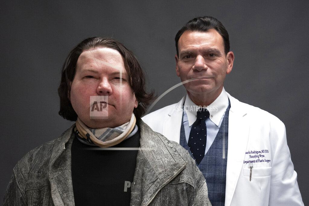 Mark Lennihan Joe DiMeo and his plastic surgeon Dr. Eduardo Rodriguez pose for a portrait, Monday, Jan. 25, 2021, in New York. In the months since his face and double hand transplant, DiMeo has not shown any signs of rejecting his new face or hands, said Rodriguez, the director of NYU Langone’s Face Transplant Program. (AP Photo/Mark Lennihan)