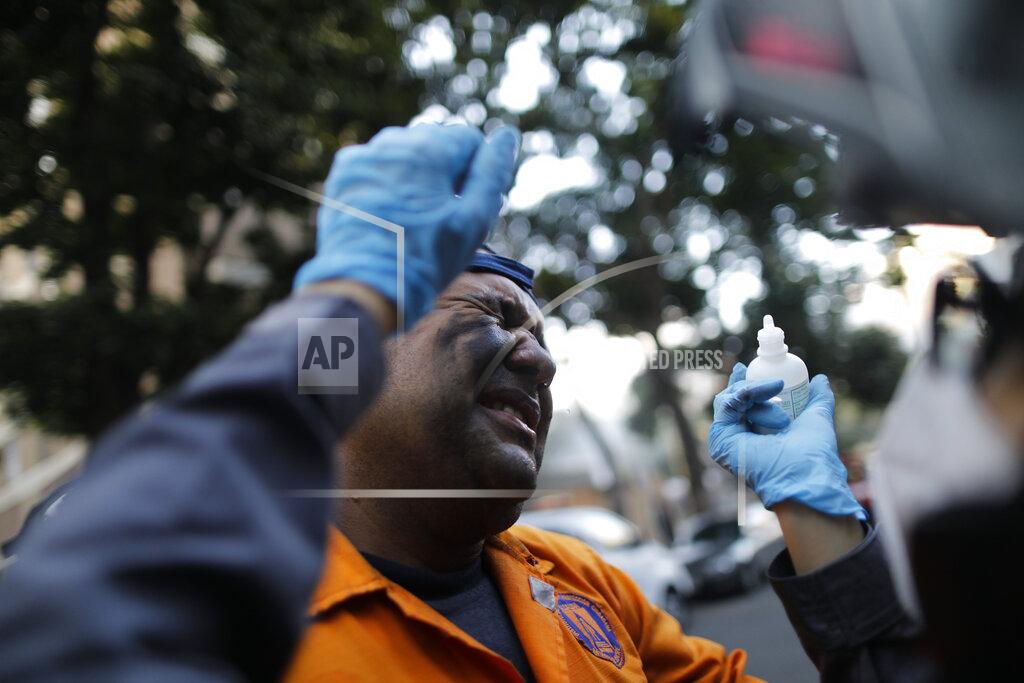 Ariana Cubillos A civil defense worker grimaces as Angels of the Road paramedic volunteer Zully Rodiz applies drops on his eyes after a car fire at a parking lot in Caracas, Venezuela, Monday, Feb. 8, 2021. Rodiz is trained as an architect and earns a living managing social media websites. She has picked up first aid basics through courses and on‑the‑job learning. (AP Photo/Ariana Cubillos)