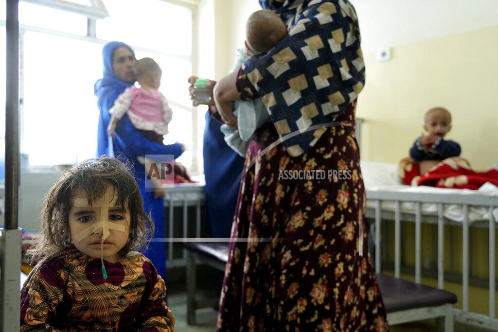 Ebrahim Noroozi Malnourished child is treated at the Indira Gandhi hospital in Kabul, Afghanistan, Wednesday, May 18, 2022. Some 1.1 million Afghan children under the age of five will face malnutrition by the end of the year. , as hospitals wards are already packed with sick children . (AP Photo/Ebrahim Noroozi)