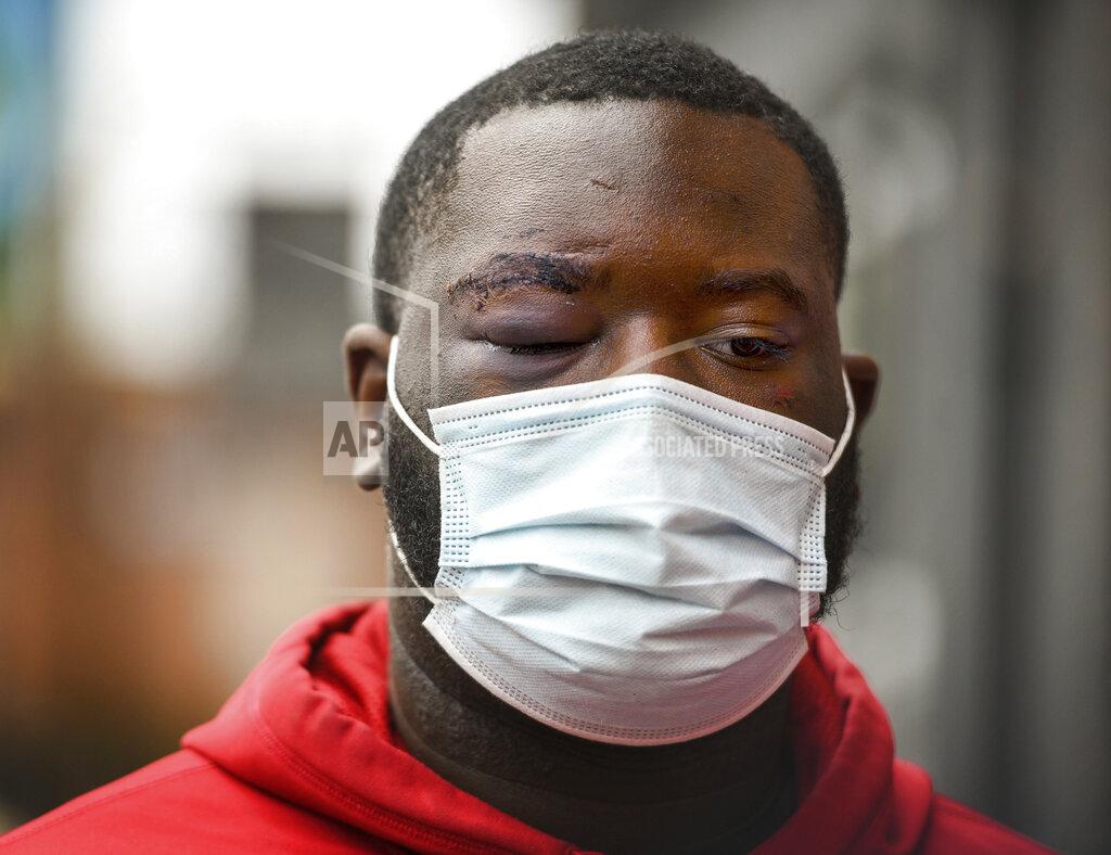 Steve Mellon De'Vincent Spriggs stands outside of the Pittsburgh Police Zone 3 station on Wednesday, April 14, 2021, in Pittsburgh. Spriggs told Pittsburgh police Wednesday that Los Angeles Rams defensive lineman Aaron Donald and others assaulted the him at a nightclub last weekend, causing multiple injuries. (Steve Mellon/Pittsburgh Post-Gazette via AP)