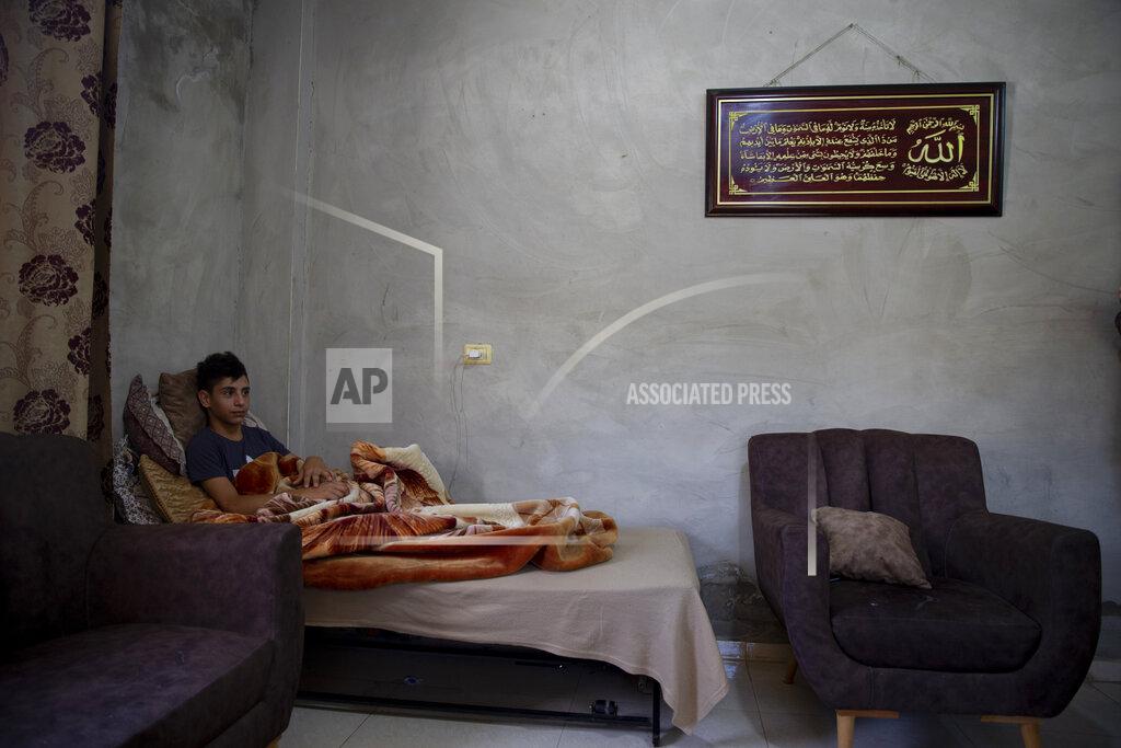 Majdi Mohammed Palestinian youth, Tareq Zubeidi, 15, rests at his house, in the West Bank village of Silat ad-Dhahr, Tuesday, Aug. 31, 2021. Zubeidi says he was abducted and beaten by a group of Israeli settlers after they found him and his friends eating snacks near an evacuated hilltop settlement in the occupied West Bank. More than two weeks after the Aug. 17 incident, he says he can barely walk and is afraid to leave his home. (AP Photo/Majdi Mohammed)