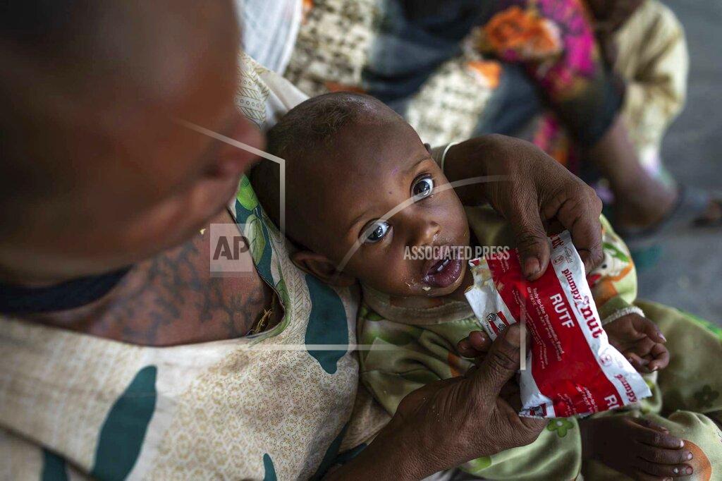 Mulugeta Ayene Letmedhin Eyasu holds her one year-old son Zewila Gebru, who is suffering from malnutrition at a health center in Agbe, Ethiopia Monday, June 7, 2021. For months, the United Nations has warned of famine in Tigray and now internal documents and witness accounts reveal the first starvation deaths since Ethiopia's government in June imposed what the U.N. calls "a de facto humanitarian aid blockade." (Mulugeta Ayene/UNICEF via AP)
