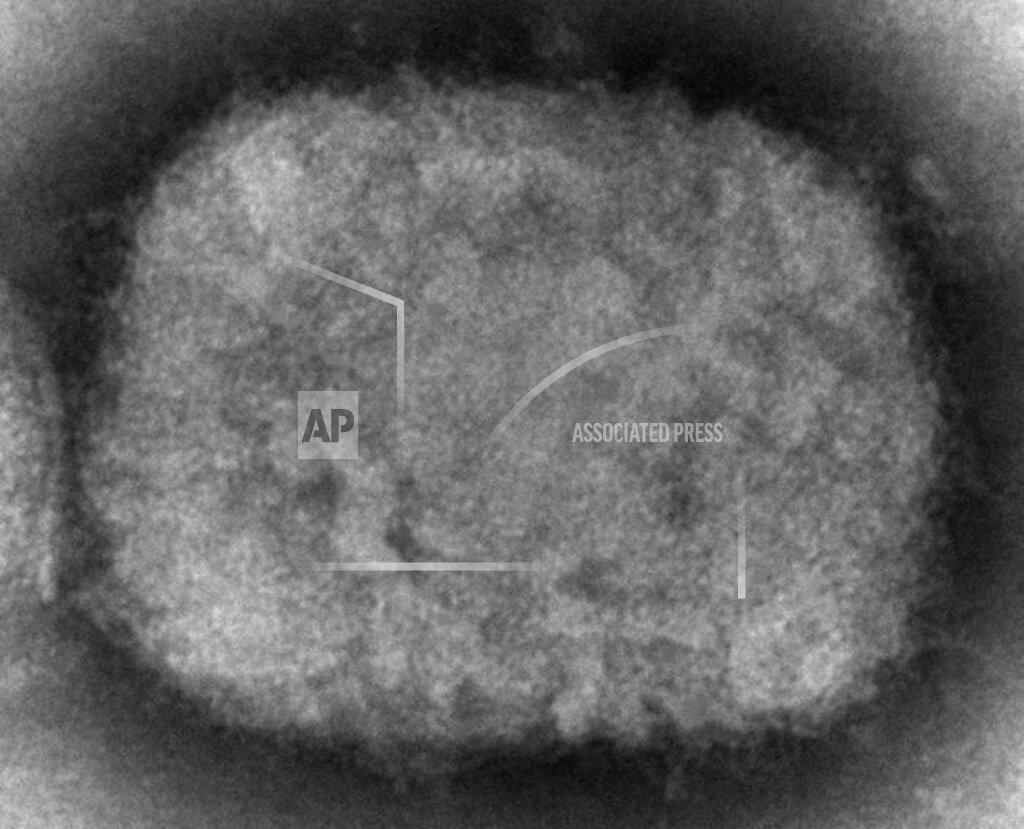 Cynthia S. Goldsmith FILE - This 2003 electron microscope image made available by the Centers for Disease Control and Prevention shows a monkeypox virion, obtained from a sample associated with the 2003 prairie dog outbreak. Monkeypox, a disease that rarely appears outside Africa, has been identified by European and American health authorities in recent days. On Friday, May 27, 2022 The Associated Press reported on stories circulating online incorrectly claiming the recent cases of monkeypox are actually just shingles, and the cases are a result of the COVID-19 vaccine. (Cynthia S. Goldsmith, Russell Regner/CDC via AP, File)