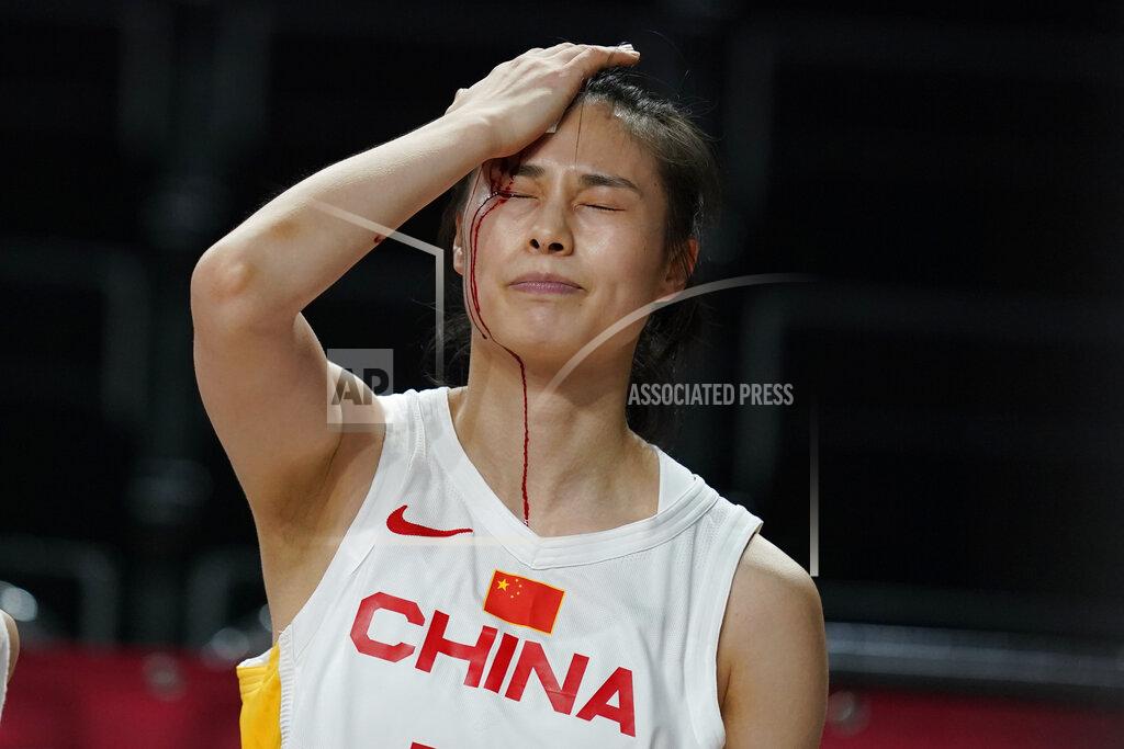 Charlie Neibergall China's Siyu Wang (5) bleeds from her head after colliding with Australia's Katie Ebzery during a women's basketball preliminary round game at the 2020 Summer Olympics in Saitama, Japan, Friday, July 30, 2021. (AP Photo/Charlie Neibergall)