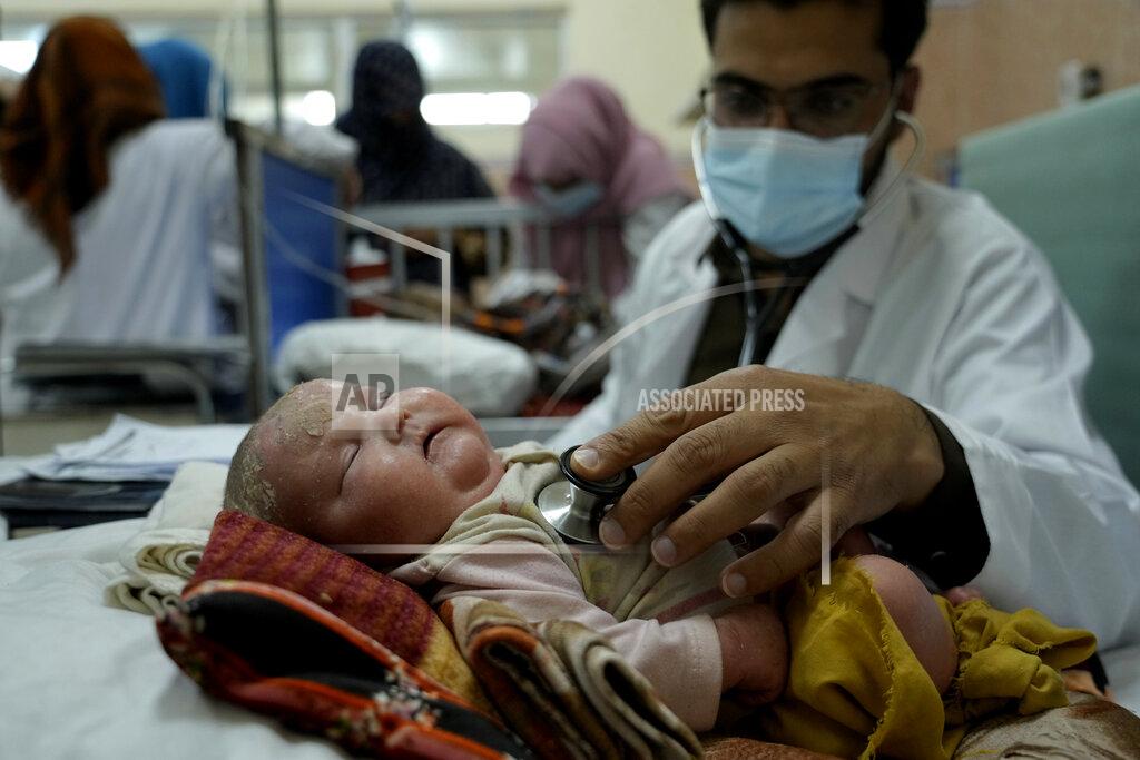 Ebrahim Noroozi A doctor examines a malnourished child in he Indira Gandhi hospital in Kabul, Afghanistan, Sunday, May 22, 2022. Some 1.1 million Afghan children under the age of five will face malnutrition by the end of the year. , as hospitals wards are already packed with sick children . (AP Photo/Ebrahim Noroozi)