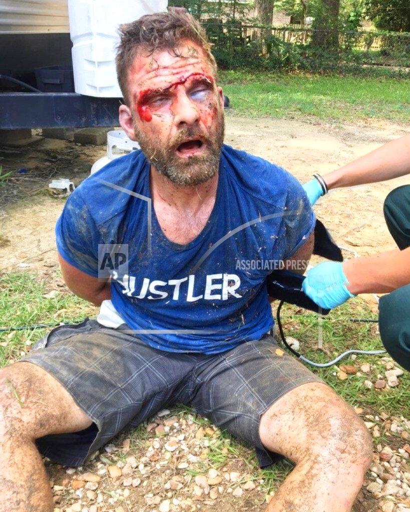 Uncredited In this August 2019 photo provided by his attorney, Darrell Smith is apprehended by Louisiana State Police troopers after fleeing a a traffic stop near Baton Rouge, La. Smith's lawsuit says troopers shared this photo of him after a beating, with his eyes swollen shut, and the caption: "This is what happens when you run from the police." (Haley & Associates via AP)