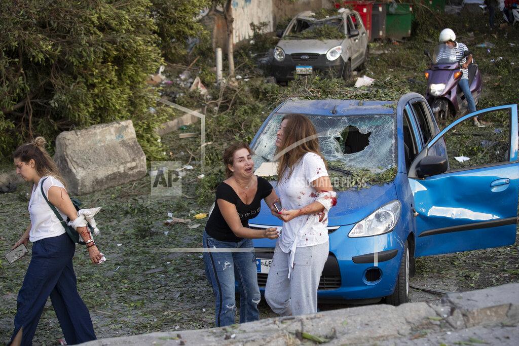 Hassan Ammar Injured people stand after of a massive explosion in Beirut, Lebanon, Tuesday, Aug. 4, 2020. (AP Photo/Hassan Ammar)