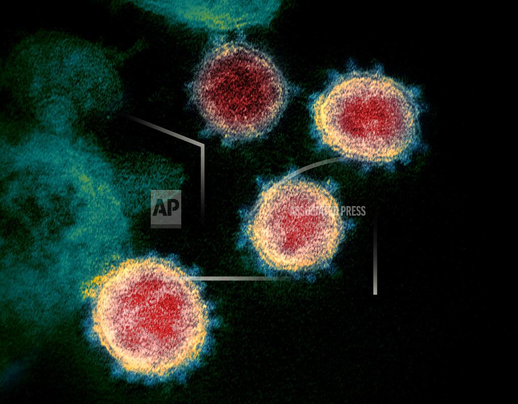 Uncredited FILE - This undated electron microscope image made available by the U.S. National Institutes of Health in February 2020 shows the virus that causes COVID-19. The sample was isolated from a patient in the U.S. On Friday, Dec. 11, 2020, The Associated Press reported on stories circulating online incorrectly asserting that scientists have not isolated the COVID-19 virus, so a vaccine is not possible. The virus was first isolated by Chinese authorities on Jan. 7, according to the World Health Organization. (NIAID-RML via AP)
