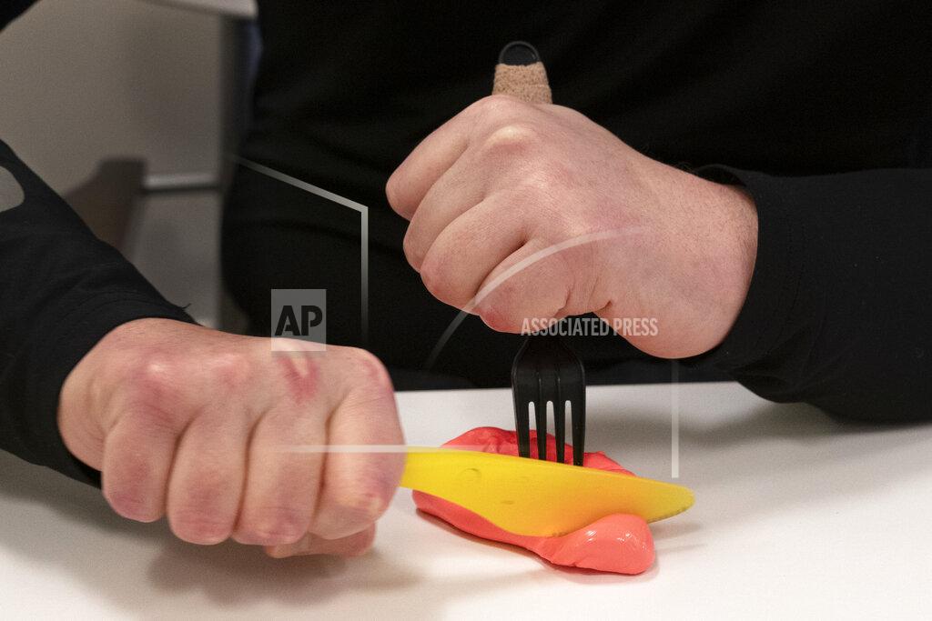 Mark Lennihan Joe DiMeo uses his new hands to grasp a knife and fork to cut some modeling plastic during an occupational therapy session, Jan. 25, 2021 in New York. DiMeo has been in intensive rehabilitation, devoting hours daily to physical, occupational and speech therapy. (AP Photo/Mark Lennihan)