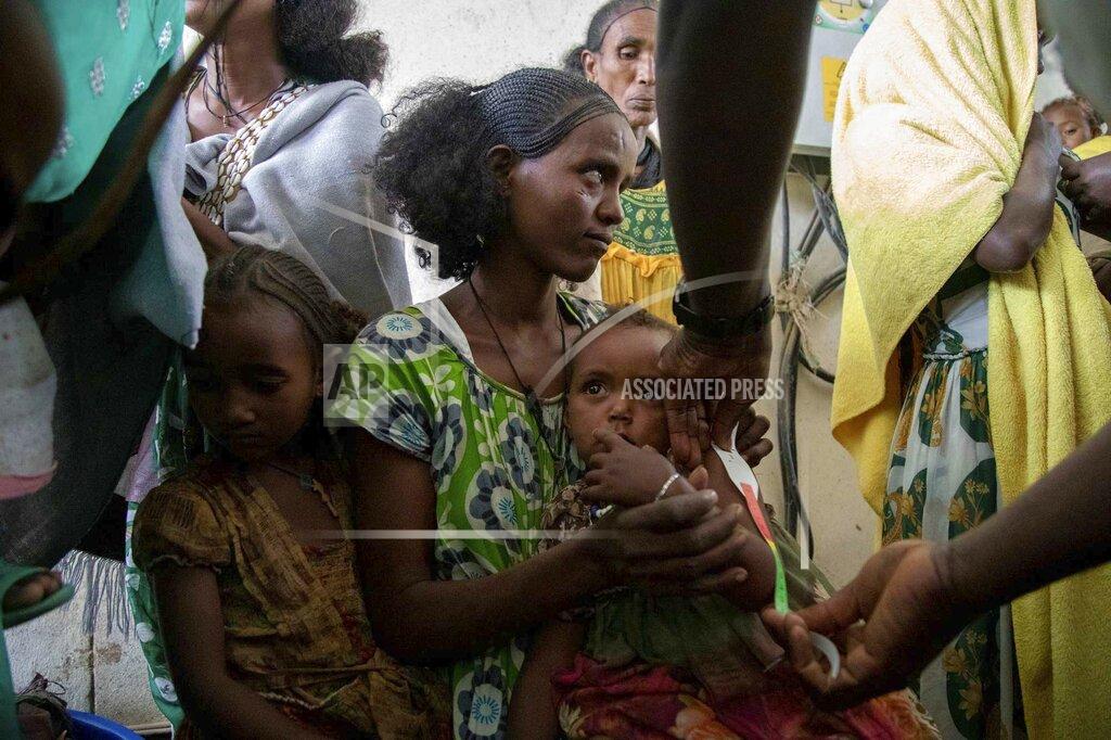 Christine Nesbitt A woman holds a child during a screening for malnutrition in pregnant and lactating women by UNICEF and partners in Gijet in the Tigray region of northern Ethiopia Tuesday, July 20, 2021. For months, the United Nations has warned of famine in Tigray and now internal documents and witness accounts reveal the first starvation deaths since Ethiopia's government in June imposed what the U.N. calls "a de facto humanitarian aid blockade." (Christine Nesbitt/UNICEF via AP)