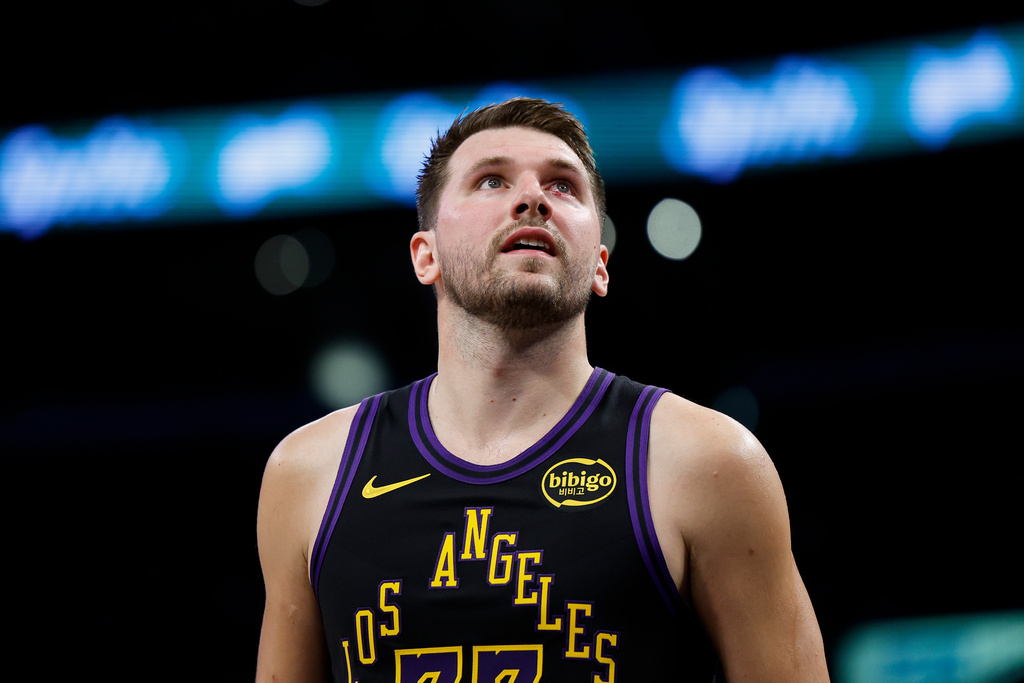 Los Angeles Lakers guard Luka Doncic (77) plays after getting scratched under the eye during the first half of an NBA basketball game against the Orlando Magic, Tuesday, Feb. 24, 2026, in Los Angeles. (AP Photo/Caroline Brehman)