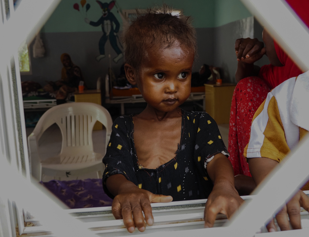 Four-year-old Farhia, who is suffering from severe acute malnutrition, looks through a window at a hospital in Qardho, Puntland, Somalia, Friday, April 17, 2026. (AP Photo/Jack Denton)