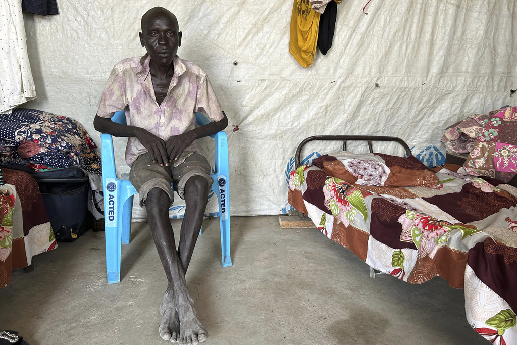 Michael Deng Dut, 29 years-old, who says he was electrocuted more than 18 times after his arrest by the Sudanese Armed Forces, poses for a photo during an interview with The Associated Press in Renk, South Sudan, Thursday, Aug 7, 2025. (AP Photo/Adlai Coleman)